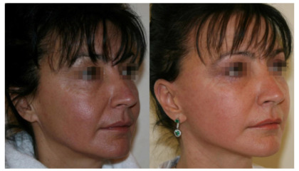 Creation of the website of the Ukrainian Academy of Plastic Surgery uaps.in.ua